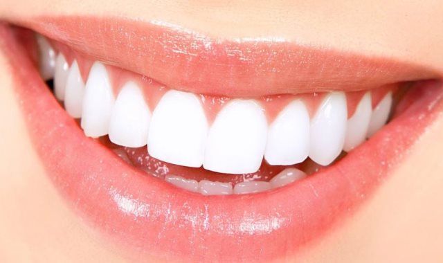 كثير من العلاجات الطبيعية تساعد على تخفيف آلام الأسنان 