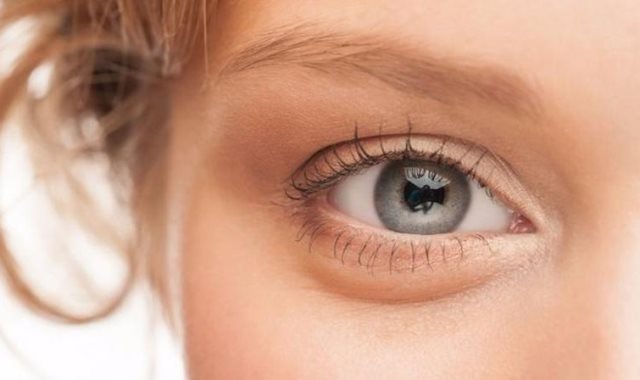 4 طرق للتخلص من انتفاخات العين