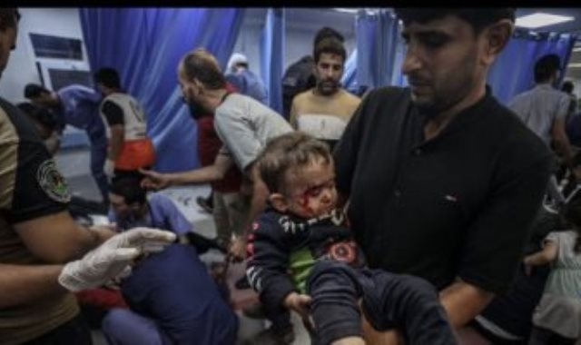 طفل مصاب في غزة
