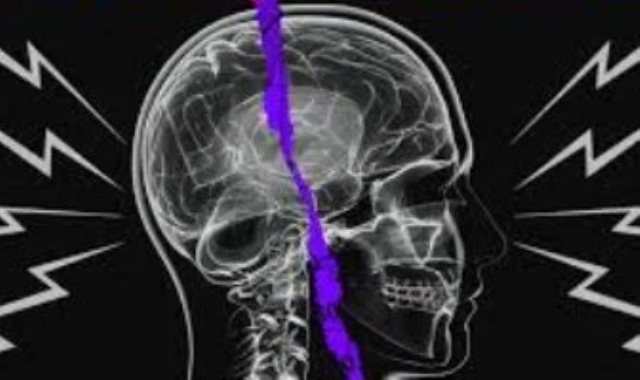 متلازمة هافانا