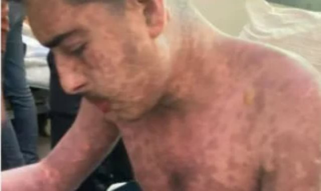 الشاب محمد ضبان