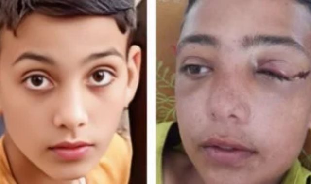 الطفل عبد الرحمن أبو جزر