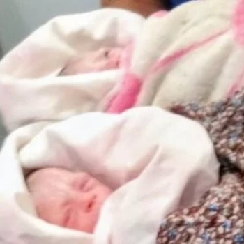 نجاح ولادة طفلين «توأم» داخل سيارة إسعاف بحي إمبابة بالجيزة