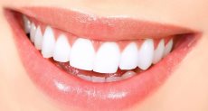 كثير من العلاجات الطبيعية تساعد على تخفيف آلام الأسنان 