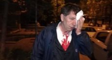 الصحفى التركي بعد الاعتداء عليه