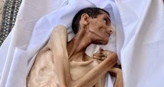 شاب فلسطينى يموت جوعا فى مستشفى الشفاء